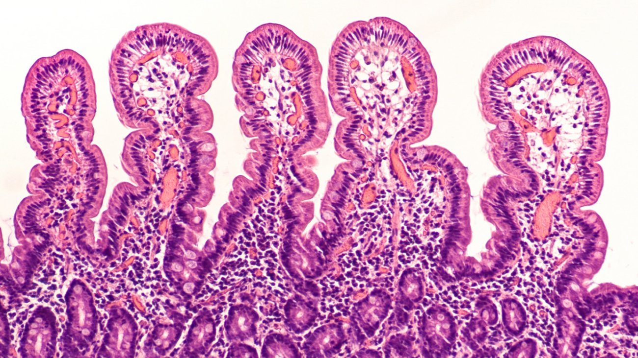 Integridad del Intestino del Lechón